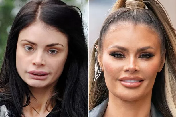 Chloe Sims Before and After