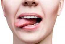 creamy taste in mouth diabetes
