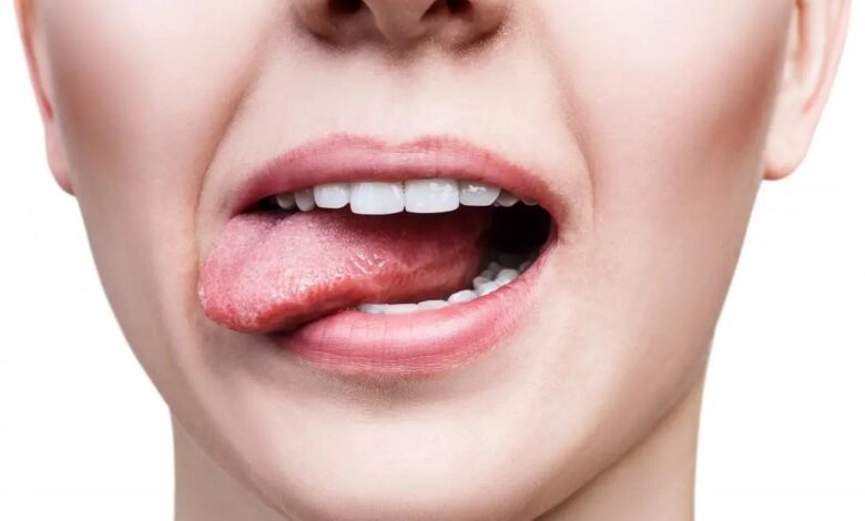 creamy taste in mouth diabetes