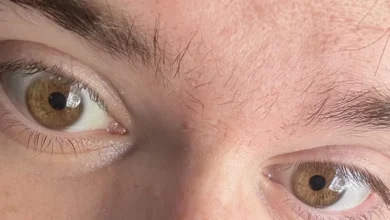 Rugby Ball Shaped Eyes