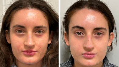 Polynucleotide Treatment