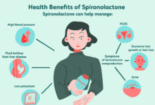 Spironolaktonas