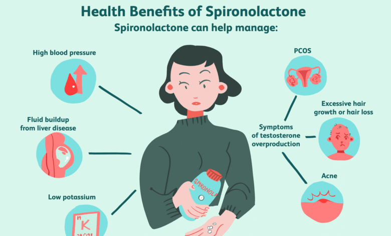 Spironolaktonas